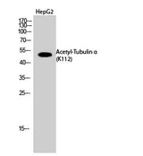 Tubulin α (Acetyl Lys112) rabbit pAb