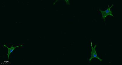 STAB2 rabbit pAb 50µL/100µL