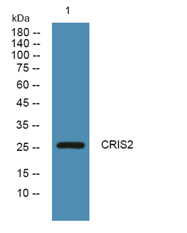 CRIS2 rabbit pAb 50µL/100µL