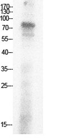 Ub (Acetyl Lys29) rabbit pAb 50µL/100µL