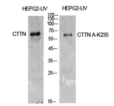 Cortactin (Acetyl Lys235) rabbit pAb