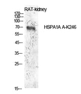 HSP70 (Acetyl Lys246) rabbit pAb 50µL/100µL