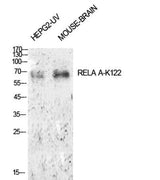 NFκB-p65 (Acetyl Lys122) rabbit pAb