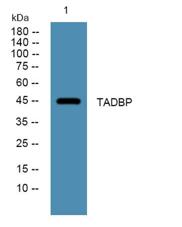 TADBP rabbit pAb 50µL/100µL