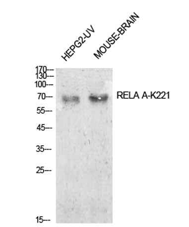 NFκB-p65 (Acetyl Lys221) rabbit pAb
