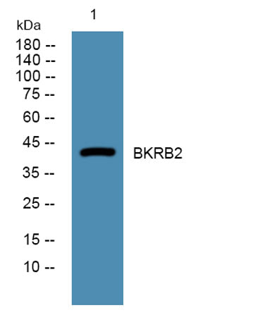 BKRB2 rabbit pAb 50µL/100µL