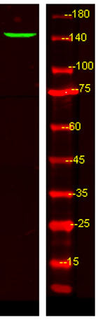 LPHN3 rabbit pAb 50µL/100µL