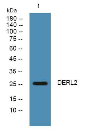 DERL2 rabbit pAb