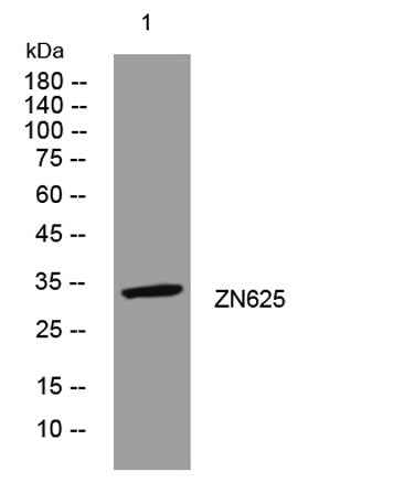 ZN625 rabbit pAb