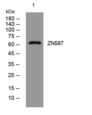 ZN587 rabbit pAb 50µL/100µL
