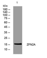 ZFN2A rabbit pAb