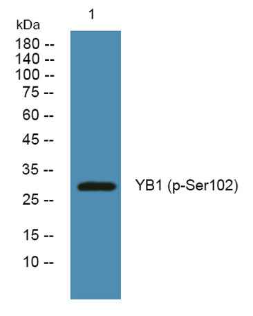 YB1 (phospho-Ser102) rabbit pAb