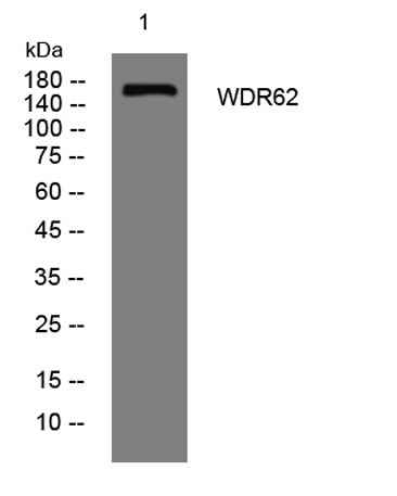 WDR62 rabbit pAb