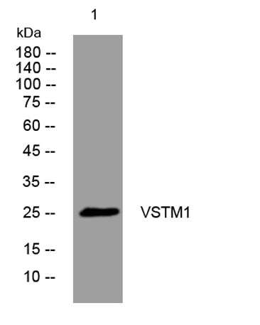 VSTM1 rabbit pAb 50µL/100µL