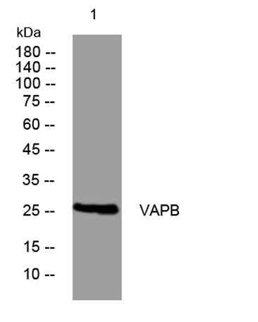 VAPB rabbit pAb