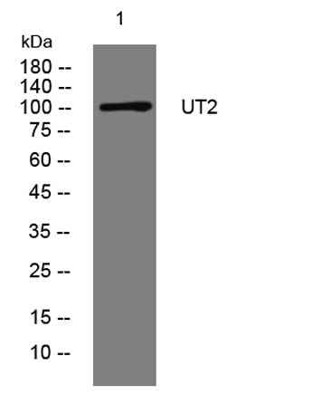UT2 rabbit pAb