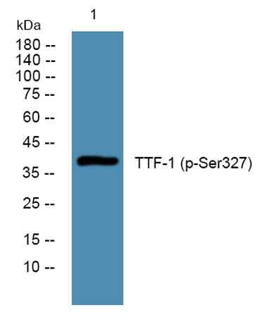 TTF-1 (phospho-Ser327) rabbit pAb