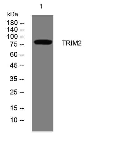 TRIM2 rabbit pAb