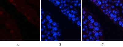 AP-1 (phospho Ser63) rabbit pAb