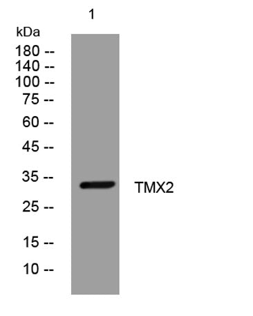 TMX2 rabbit pAb 50µL/100µL