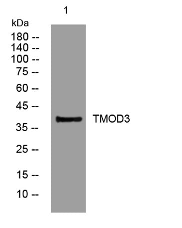 TMOD3 rabbit pAb 50µL/100µL