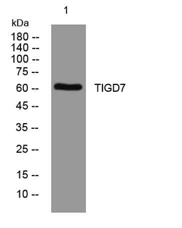 TIGD7 rabbit pAb