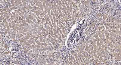Tie2 (phospho-Ser1119) rabbit pAb