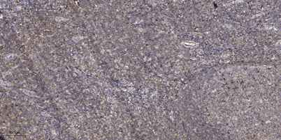 Thrombospondin 1 rabbit pAb