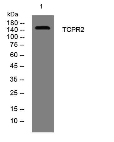 TCPR2 rabbit pAb 50µL/100µL