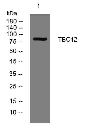 TBC12 rabbit pAb