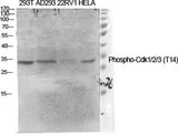 Cdk1/2/3 (phospho Thr14) rabbit pAb
