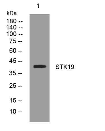 STK19 rabbit pAb