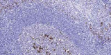 SREBP-1 (Acetyl-Lys324) rabbit pAb