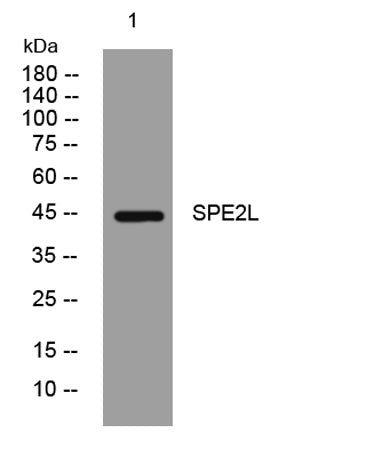 SPE2L rabbit pAb 50µL/100µL