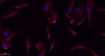 eIF2α (phospho Ser51) rabbit pAb