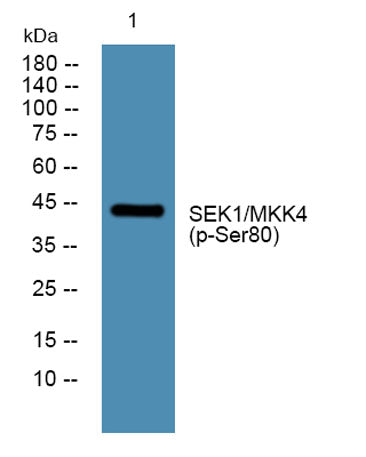 SEK1/MKK4 (phospho-Ser80) rabbit pAb 50µL/100µL