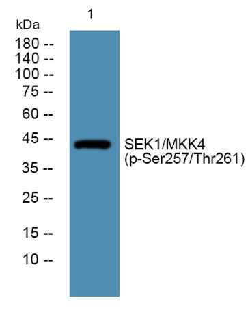 SEK1/MKK4 (phospho-Ser257/Thr261) rabbit pAb