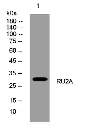 RU2A rabbit pAb