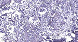 Rb (phospho-Ser807/811) rabbit pAb