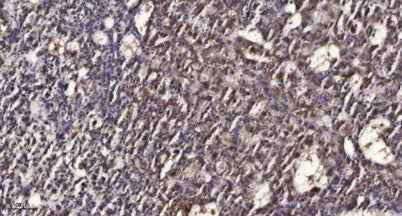 Rad50 (phospho-Ser635) rabbit pAb
