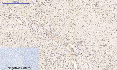 NFκB-p65 (phospho Ser276) rabbit pAb