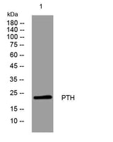 PTH rabbit pAb