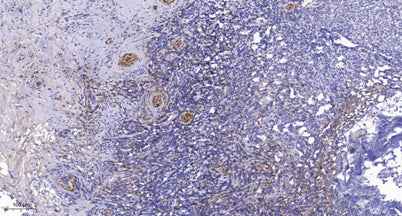 PRK1 (phospho-Thr774)/PRK2 (phospho-Thr816) rabbit pAb
