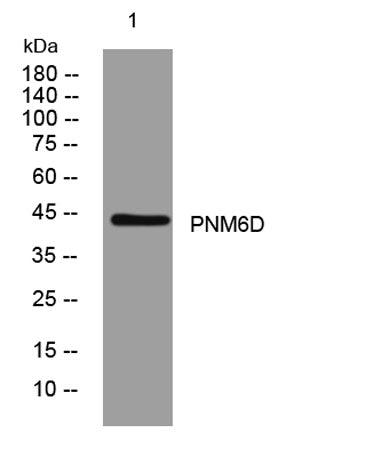 PNM6D rabbit pAb 50µL/100µL