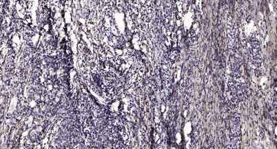 PLCγ2 (phospho-Tyr759) rabbit pAb