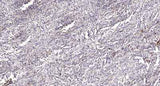 PI3 Kinase Class III (phospho-Ser249) rabbit pAb