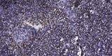 p70 S6 Kinase (phospho-Thr389) rabbit pAb