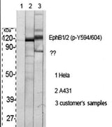 EphB1/2 (phospho Tyr594/604) rabbit pAb