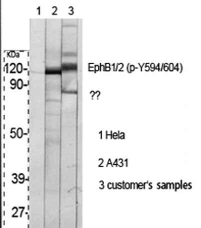 EphB1/2 (phospho Tyr594/604) rabbit pAb