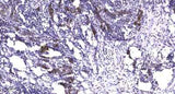 LATS1/2 (phospho-Ser909) rabbit pAb